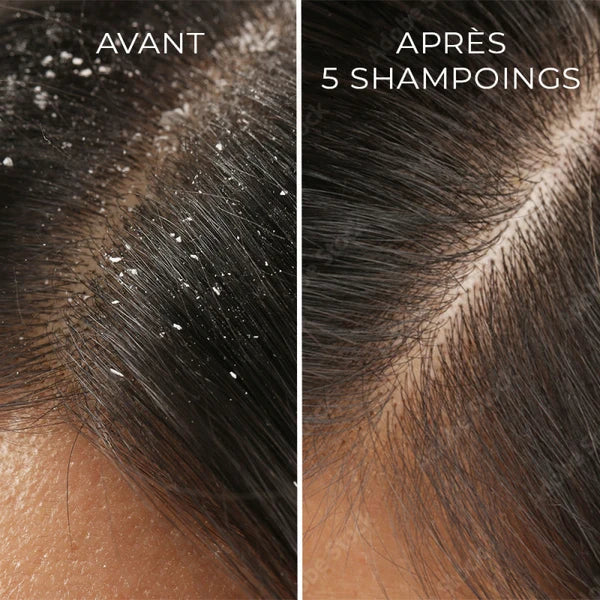Shampooing Traitant Api'Propolis Anti-Pelliculaire Bio
